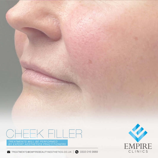 Cheek Filler injections in Liverpool