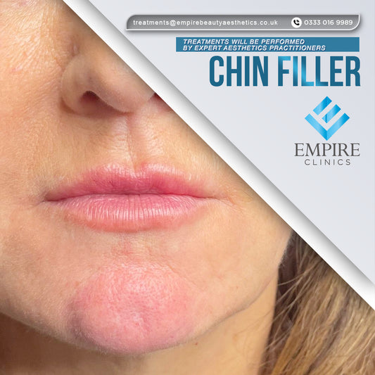 Chin Filler Augmentation