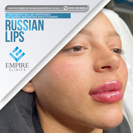 Russian Lip Augmentation