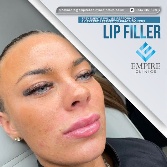 Lip Filler Augmentation